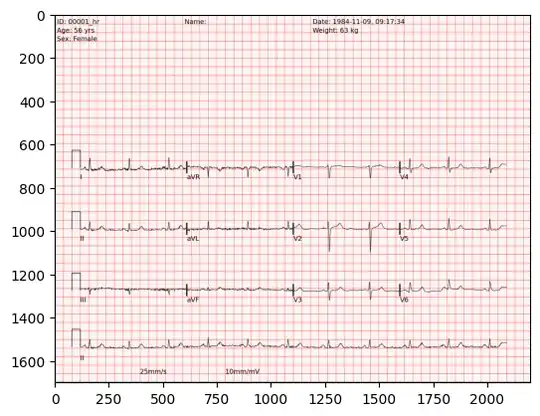 This is how an ECG image look like