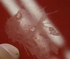 bird damage