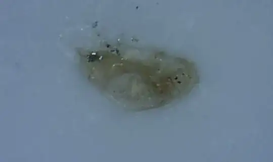 planaria
