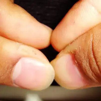 Not my hands