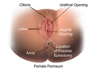Episiotomy.